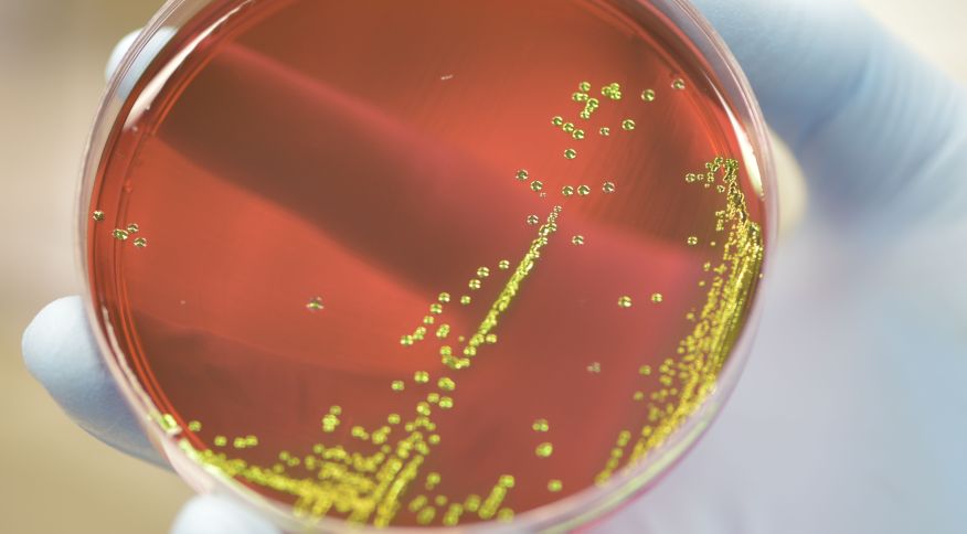 Descarte incorreto de antimicrobianos ameaça saúde global, alertam especialistas